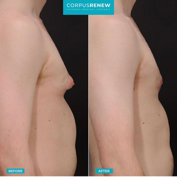 Slider image (8) CorpusRenew by Termessos Hospital